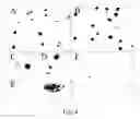 Fig. 11 - NOVEL HUMAN GENE FUNCTIONALLY RELATED TO DYSLEXIA