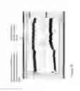 Fig. 20 - “Micro-patch” for assessment of the local microvasculature and microcirculatory vasoreactivity