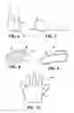 Fig. 03 - Cosmetic skin care system
