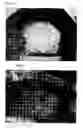 Fig. 05 - Antiadhesive Kit, Process for Producing the Same and Method of Adhesion Prevention