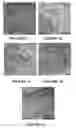 Fig. 03 - System and method for forming bone, ligament, and bone-ligament constructs