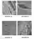 Fig. 06 - System and method for forming bone, ligament, and bone-ligament constructs