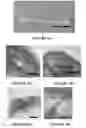 Fig. 11 - System and method for forming bone, ligament, and bone-ligament constructs