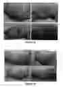 Fig. 04 - Wound healing agent and composition