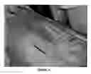 Fig. 05 - Wound healing agent and composition