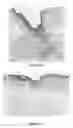 Fig. 08 - Wound healing agent and composition