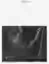 Fig. 22 - Hydrogel-metal assembly
