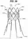 Fig. 17 - LOCAL VASCULAR DELIVERY OF PROBUCOL ALONE OR IN COMBINATION WITH SIROLIMUS TO TREAT RESTENOSIS, VULNERABLE PLAQUE, AAA AND STROKE