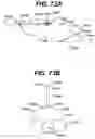 Fig. 51 - LOCAL VASCULAR DELIVERY OF PROBUCOL ALONE OR IN COMBINATION WITH SIROLIMUS TO TREAT RESTENOSIS, VULNERABLE PLAQUE, AAA AND STROKE