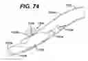 Fig. 52 - LOCAL VASCULAR DELIVERY OF PROBUCOL ALONE OR IN COMBINATION WITH SIROLIMUS TO TREAT RESTENOSIS, VULNERABLE PLAQUE, AAA AND STROKE