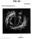 Fig. 60 - LOCAL VASCULAR DELIVERY OF PROBUCOL ALONE OR IN COMBINATION WITH SIROLIMUS TO TREAT RESTENOSIS, VULNERABLE PLAQUE, AAA AND STROKE
