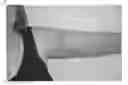 Fig. 01 - Method of treating scar tissue