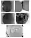 Fig. 01 - Pharmaceutical compositions comprising an active substance from the substituted benzhydrylpiperazine family