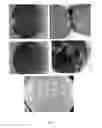 Fig. 04 - Pharmaceutical compositions comprising an active substance from the substituted benzhydrylpiperazine family