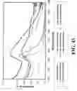 Fig. 42 - Nanoshells and Discrete Polymer-Coated Nanoshells, Methods For Making and Using Same