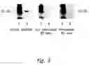 Fig. 04 - Compositions and methods for WT1 specific immunotherapy