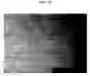 Fig. 08 - Composition for Prevention and Treatment of Stretch Mark Comprising Citric Acid, Zinc and Arginine