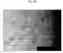 Fig. 16 - Composition for Prevention and Treatment of Stretch Mark Comprising Citric Acid, Zinc and Arginine