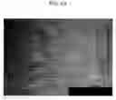 Fig. 19 - Composition for Prevention and Treatment of Stretch Mark Comprising Citric Acid, Zinc and Arginine