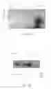 Fig. 04 - Compositions & methods for activation and inhibition of Staphylococcus aureus biofilm development
