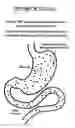 Fig. 01 - Method and composition of a carminative herb or natural supplement to decrease the adverse events of orlistat, an oral lipase inhibitor
