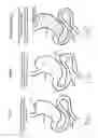 Fig. 02 - Method and composition of a carminative herb or natural supplement to decrease the adverse events of orlistat, an oral lipase inhibitor