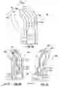 Fig. 13 - Cam System For A Mold