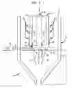 Fig. 02 - Method for fabricating a medical component from a material having a high carbide phase