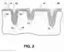 Fig. 03 - Article having a stained molded three-dimensional wood grain