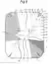 Fig. 06 - Flower Vase and Blank for the Production Thereof