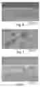Fig. 04 - Process for forming microporous membranes