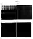 Fig. 04 - VIRAL FIBERS
