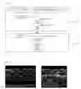 Fig. 03 - MCFC anode for direct  internal reforming of ethanol, manufacturing process thereof, and method for direct internal reforming in MCFC containing the anode