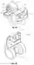 Fig. 04 - TWO-PART SELF-LIGATING ORTHODONTIC BRACKET HAVING LATERAL GUIDING MECHANISM