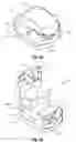 Fig. 06 - TWO-PART SELF-LIGATING ORTHODONTIC BRACKET HAVING LATERAL GUIDING MECHANISM