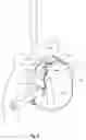Fig. 09 - TWO-PART SELF-LIGATING ORTHODONTIC BRACKET HAVING LATERAL GUIDING MECHANISM