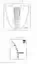 Fig. 06 - Root canal length measuring apparatus and root canal therapy apparatus