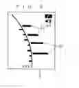 Fig. 07 - Root canal length measuring apparatus and root canal therapy apparatus