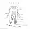 Fig. 16 - Root canal length measuring apparatus and root canal therapy apparatus