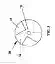 Fig. 04 - IMPLANT THREAD DESIGN