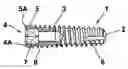 Fig. 01 - Tooth implant