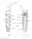 Fig. 06 - Dental implant with improved osseointegration features
