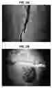 Fig. 03 - Kits, their production and method for brightening coating of teeth