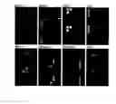 Fig. 01 - Method and microarray for detecting herpesviruses