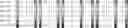 Fig. 103 - Method for HLA typing