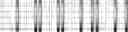 Fig. 145 - Method for HLA typing