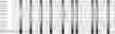 Fig. 16 - Method for HLA typing
