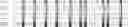 Fig. 19 - Method for HLA typing