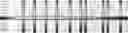 Fig. 31 - Method for HLA typing
