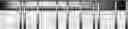 Fig. 62 - Method for HLA typing